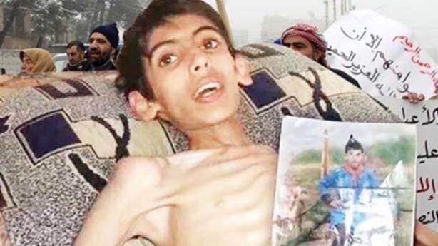 Açlığın şehri Madaya nasıl bu hale geldi?