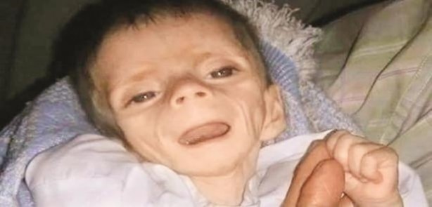 Foto - Açlığın şehri Madaya nasıl bu hale geldi?