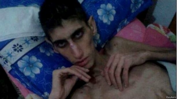 Foto - Açlığın şehri Madaya nasıl bu hale geldi?