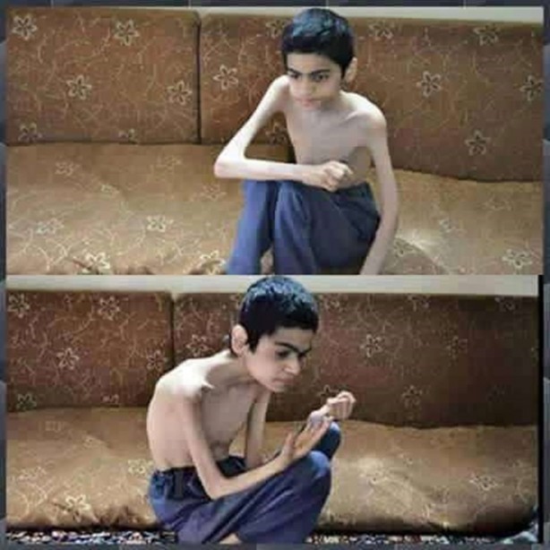 Foto - Açlığın şehri Madaya nasıl bu hale geldi?