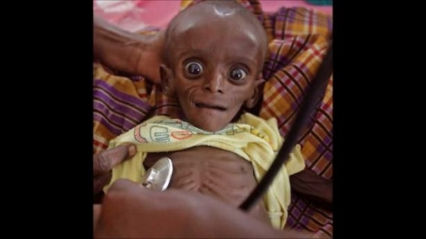 Foto - Açlığın şehri Madaya nasıl bu hale geldi?