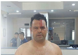 Foto - Acun Ilıcalı'nın ünlü ettiği Survivor yarışmacısı ortalığı birbirine kattı! Şok eden görüntüler