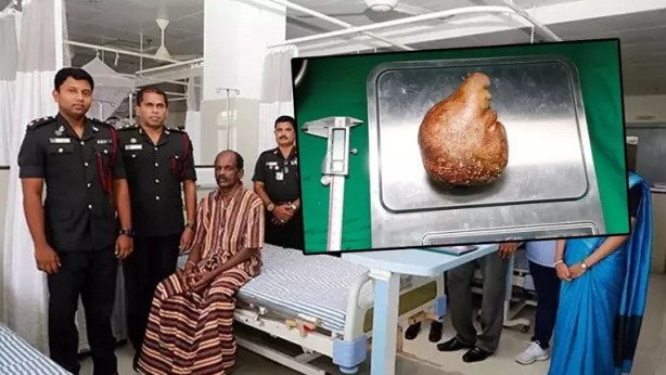 Adamın içinden çıktı! Doktorları bile şaşırtan dünya rekoru