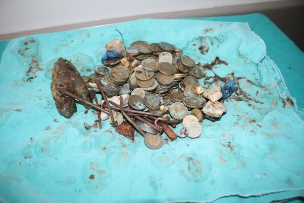 Foto - Adamın midesinden çıkanlar şoke etti!