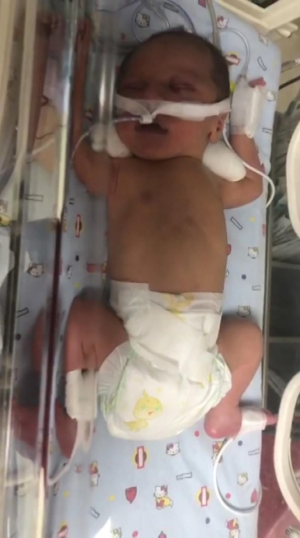 Foto - Adana'da akılalmaz olay! Bebeği öylece kundaklayıp annesine verdiler