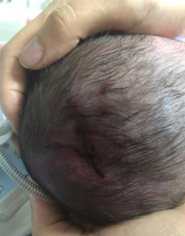 Foto - Adana'da akılalmaz olay! Bebeği öylece kundaklayıp annesine verdiler