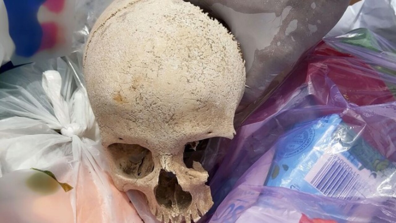 Foto - Adana’da tüyleri diken diken olay! Çöpten kağıda sarılı insan kafatası çıktı