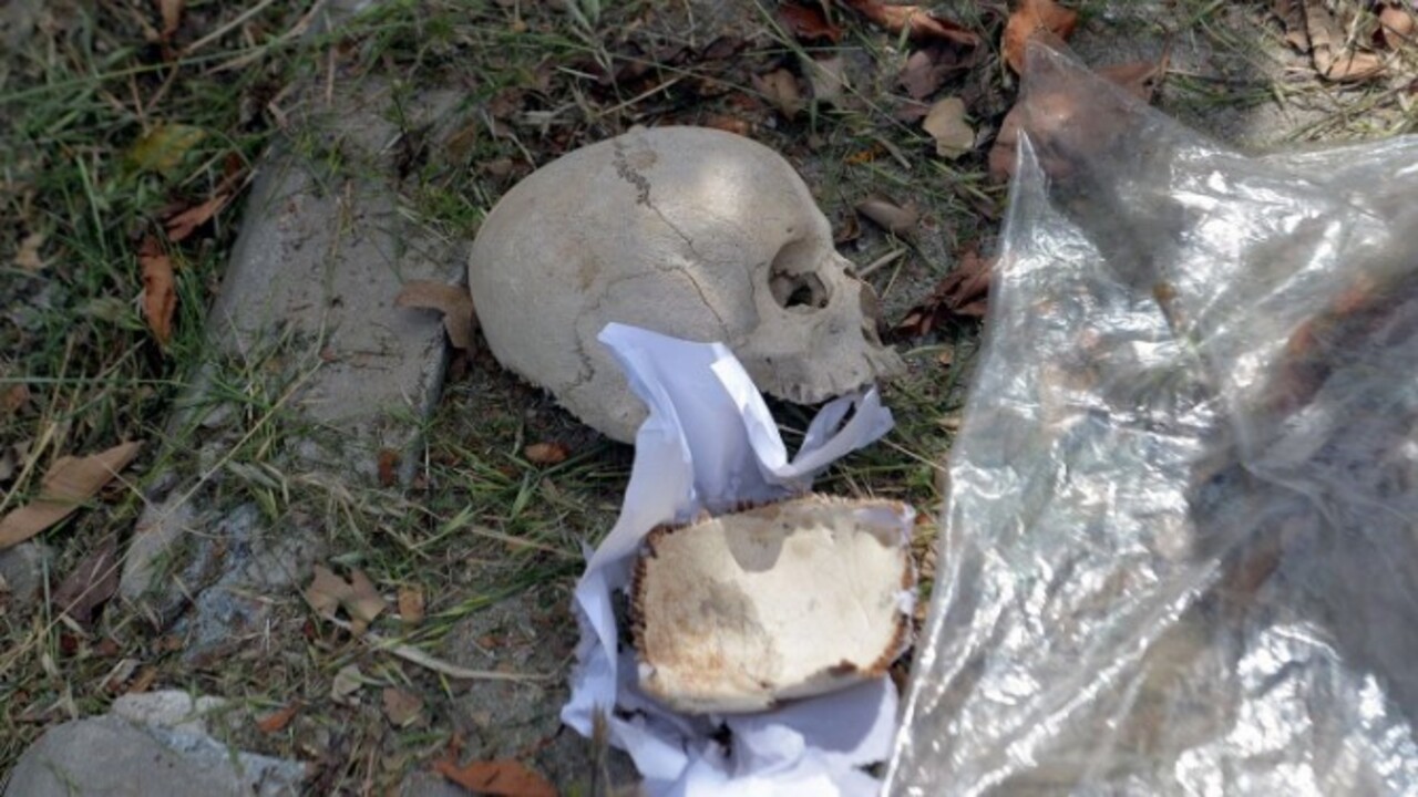 Foto - Adana’da tüyleri diken diken olay! Çöpten kağıda sarılı insan kafatası çıktı