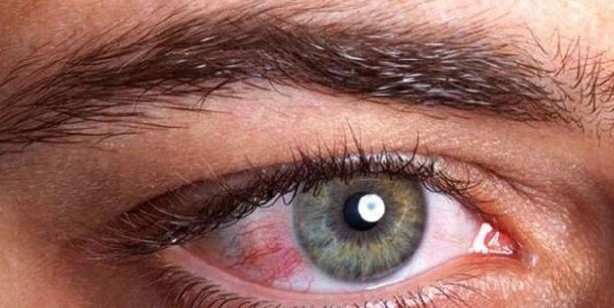 Foto - Adenovirüs gözlerimizi tehdit ediyor