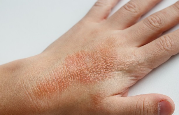 Foto - Adeta davetiye çıkarıyoruz Ellerini telefondan yüzüne götürenler dikkat