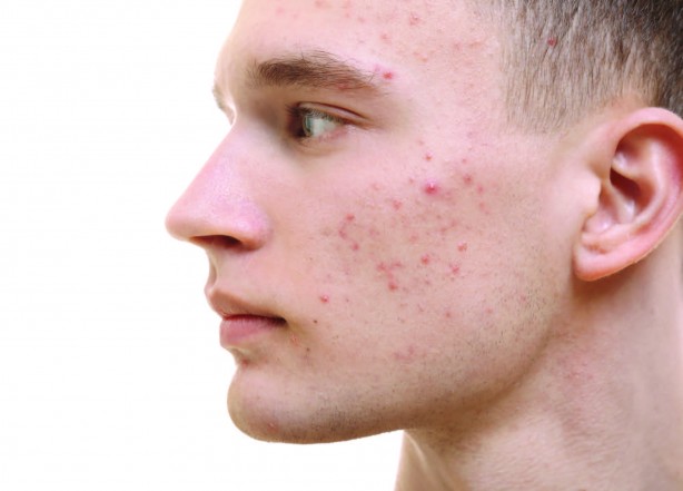 Foto - Adeta davetiye çıkarıyoruz Ellerini telefondan yüzüne götürenler dikkat