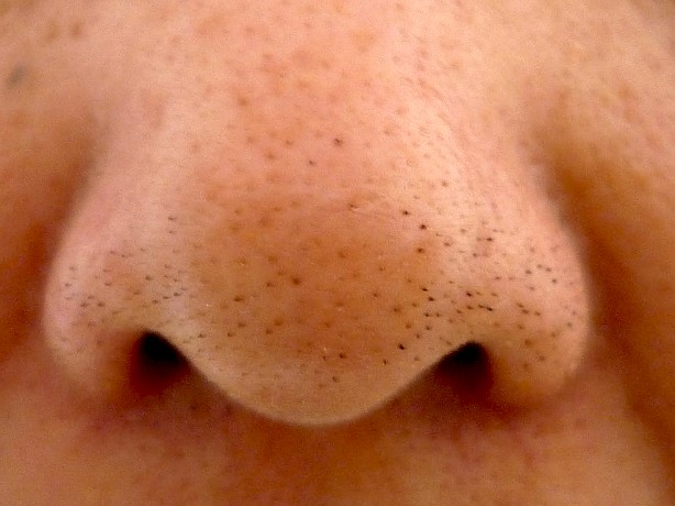 Foto - Adeta davetiye çıkarıyoruz Ellerini telefondan yüzüne götürenler dikkat