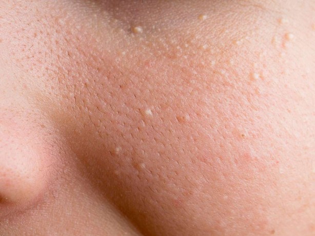 Foto - Adeta davetiye çıkarıyoruz Ellerini telefondan yüzüne götürenler dikkat