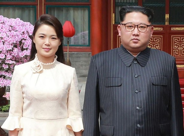 Foto - Adını değiştirdi, estetik ameliyat oldu... Kim Jong-un hakkında şok iddia!