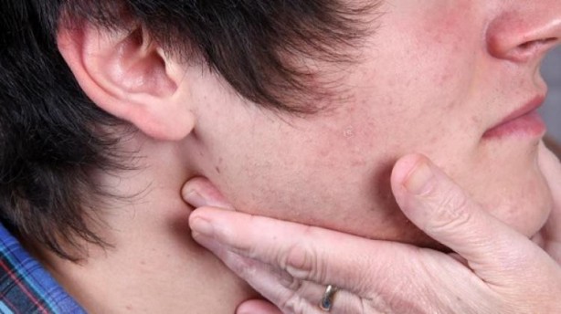 Foto - Ağız içinde çıkan yaralara dikkat! Kanser tehlikesiyle karşı karşıya olabilirsiniz