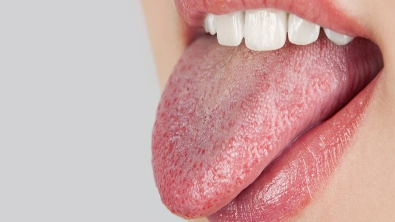 Foto - Ağız kuruluğu olanlar dikkat! 5 ciddi hastalığın sinyali olabilir