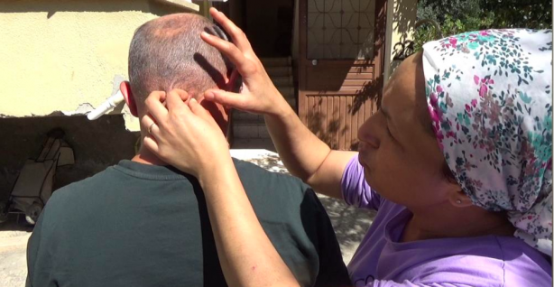 Ağızlarından, burunlarından kurtçuklar düşüyor! Sebebi şok etti! Yaşadıkları inanılmaz