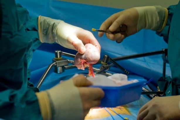 Foto - Ağrı kesicileri kullanırken bir daha düşünün