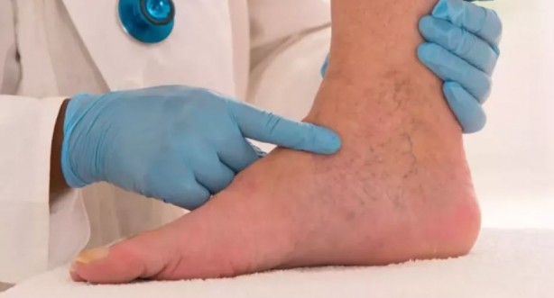 Foto - Ağrıları kökünden çözüyor! Faydalarını duyunca evinizden eksik etmeyeceksiniz