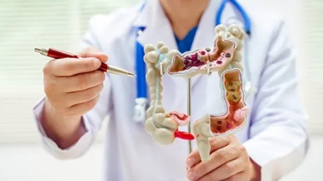 Ağzınıza bile sürmeyin: Kolon kanserine neden olan gıdalar belli oldu!
