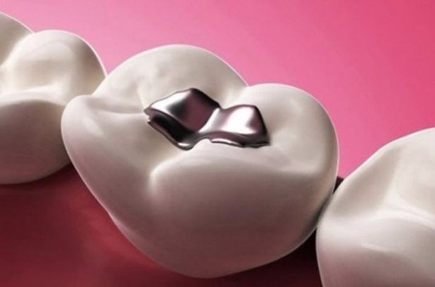  Ağzınızda bunlardan varsa...