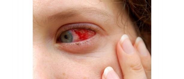 Foto - Aileler dikkat! En çok çocukları etkiliyor