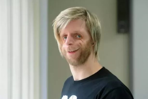 Foto - Ailesi yüzünü görünce hastanede bırakıp kaçmıştı! Hikayesini duyan gözyaşlarını tutamadı...