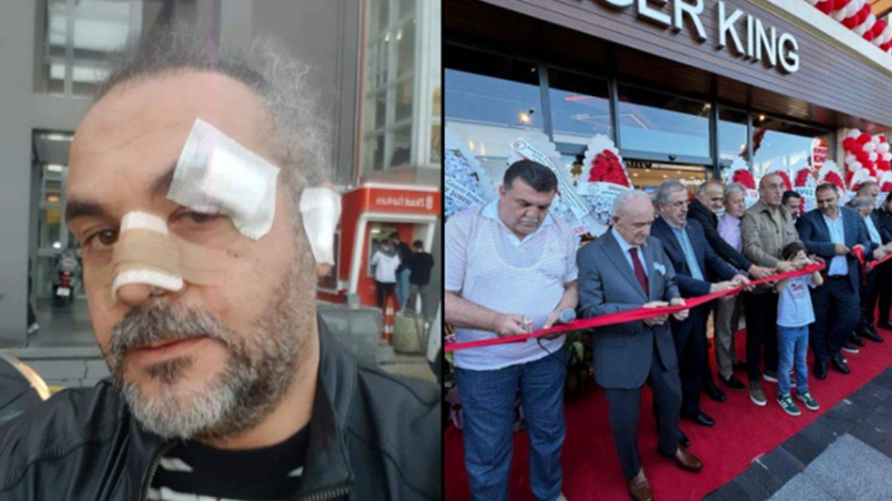 Foto - AK Parti Rize İl Başkanı Katmer, Burger King açılışıyla ilgili sessizliğini bozdu: Hepsinin arkasındayız