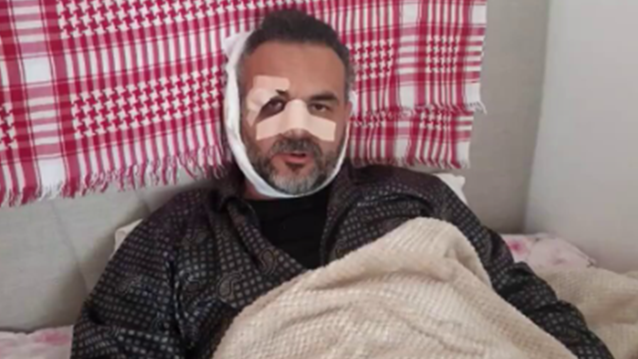 Foto - AK Parti Rize İl Başkanı Katmer, Burger King açılışıyla ilgili sessizliğini bozdu: Hepsinin arkasındayız