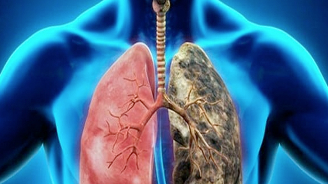 Foto - Akciğerdeki zehri 3 günde arınıyor! Solunum yollarını vakum gibi açıyor: İltihabın kökünü kurutuyor