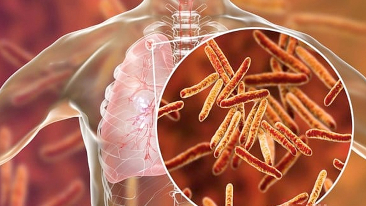 Foto - Akciğerdeki zehri 3 günde arınıyor! Solunum yollarını vakum gibi açıyor: İltihabın kökünü kurutuyor