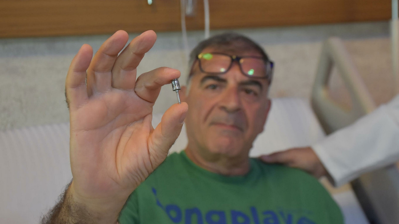 Foto - Akciğerinden çıkana inanamadı! Doktorlar bile şaşkına döndü: İlginç bir olay