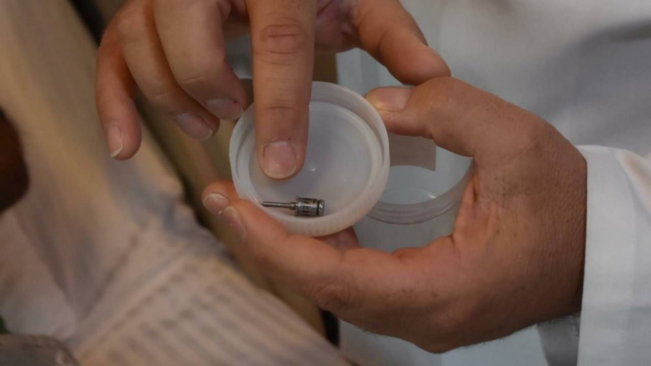 Foto - Akciğerinden çıkana inanamadı! Doktorlar bile şaşkına döndü: İlginç bir olay