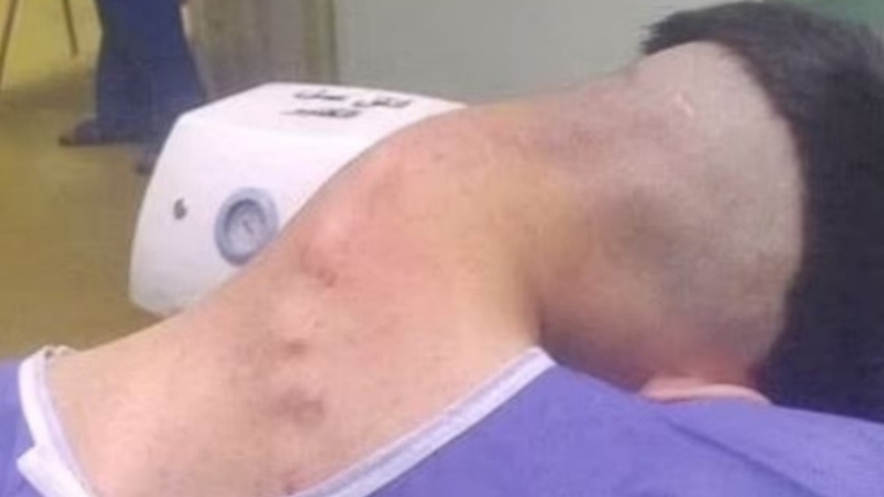 Akılalmaz olay! Boynu taşıyamadı, başı böyle düştü! "Yok artık" diyeceksiniz