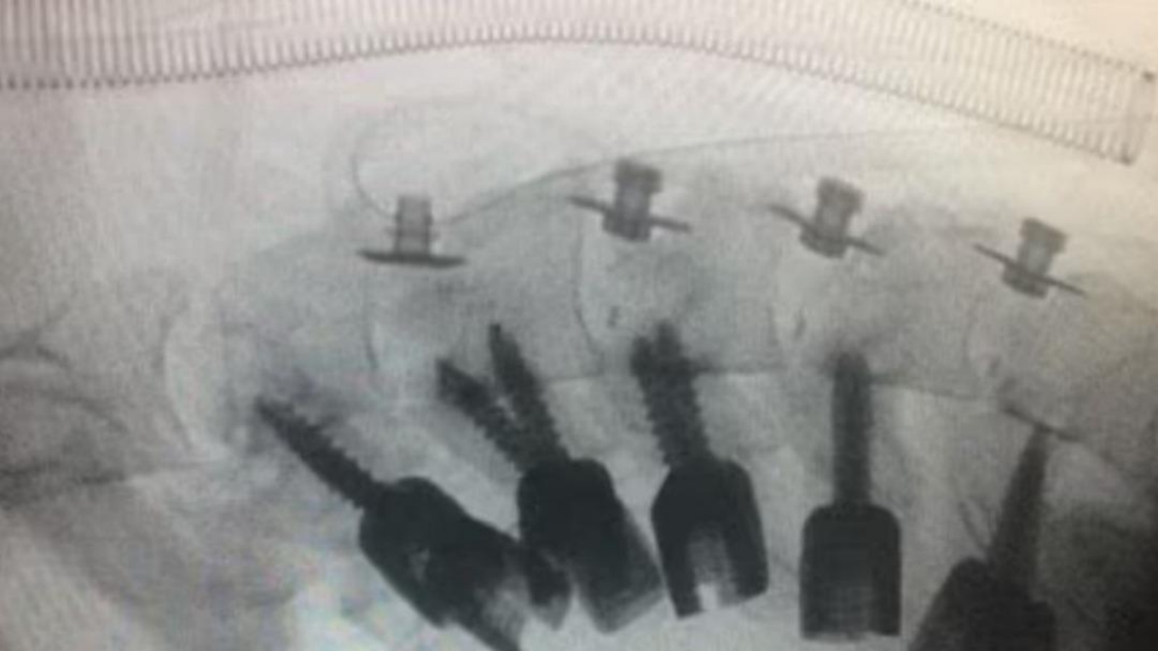 Foto - Akılalmaz olay! Boynu taşıyamadı, başı böyle düştü! "Yok artık" diyeceksiniz