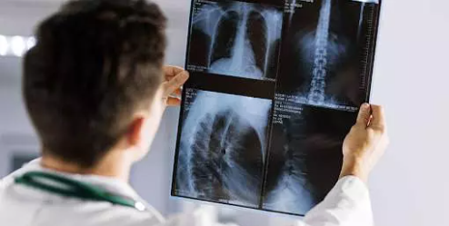 Foto - Akıllara durgunluk veren olay: Doktorlar tümör sanıp çıkardıkları şeyi görünce şaşırdı