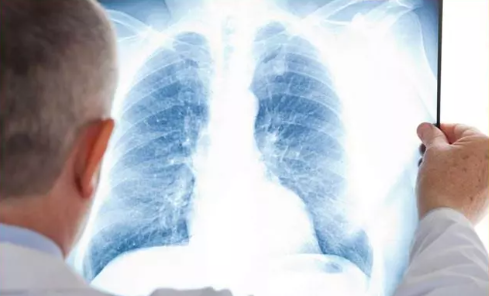 Foto - Akıllara durgunluk veren olay: Doktorlar tümör sanıp çıkardıkları şeyi görünce şaşırdı