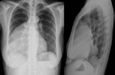 Foto - Akıllara durgunluk veren olay: Doktorlar tümör sanıp çıkardıkları şeyi görünce şaşırdı