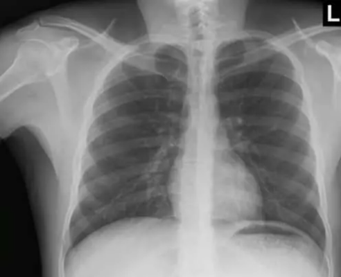 Foto - Akıllara durgunluk veren olay: Doktorlar tümör sanıp çıkardıkları şeyi görünce şaşırdı