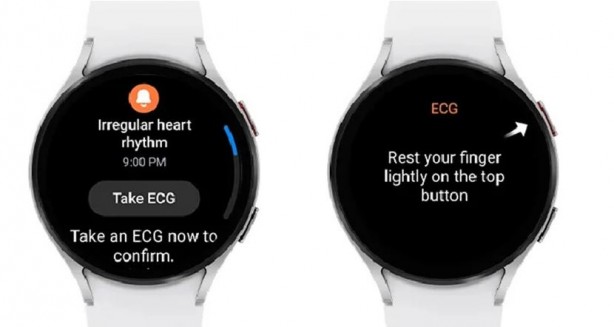 Foto - Akıllı saat kalp hastalıklarını teşhis edecek