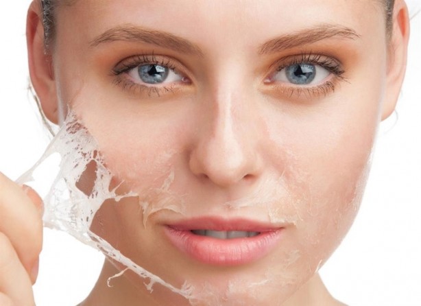 Foto - Akneler hakkında yanlış bilinen 20 yanlış