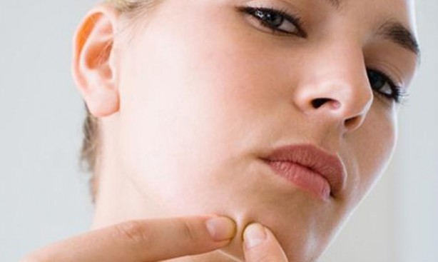 Foto - Akneler hakkında yanlış bilinen 20 yanlış