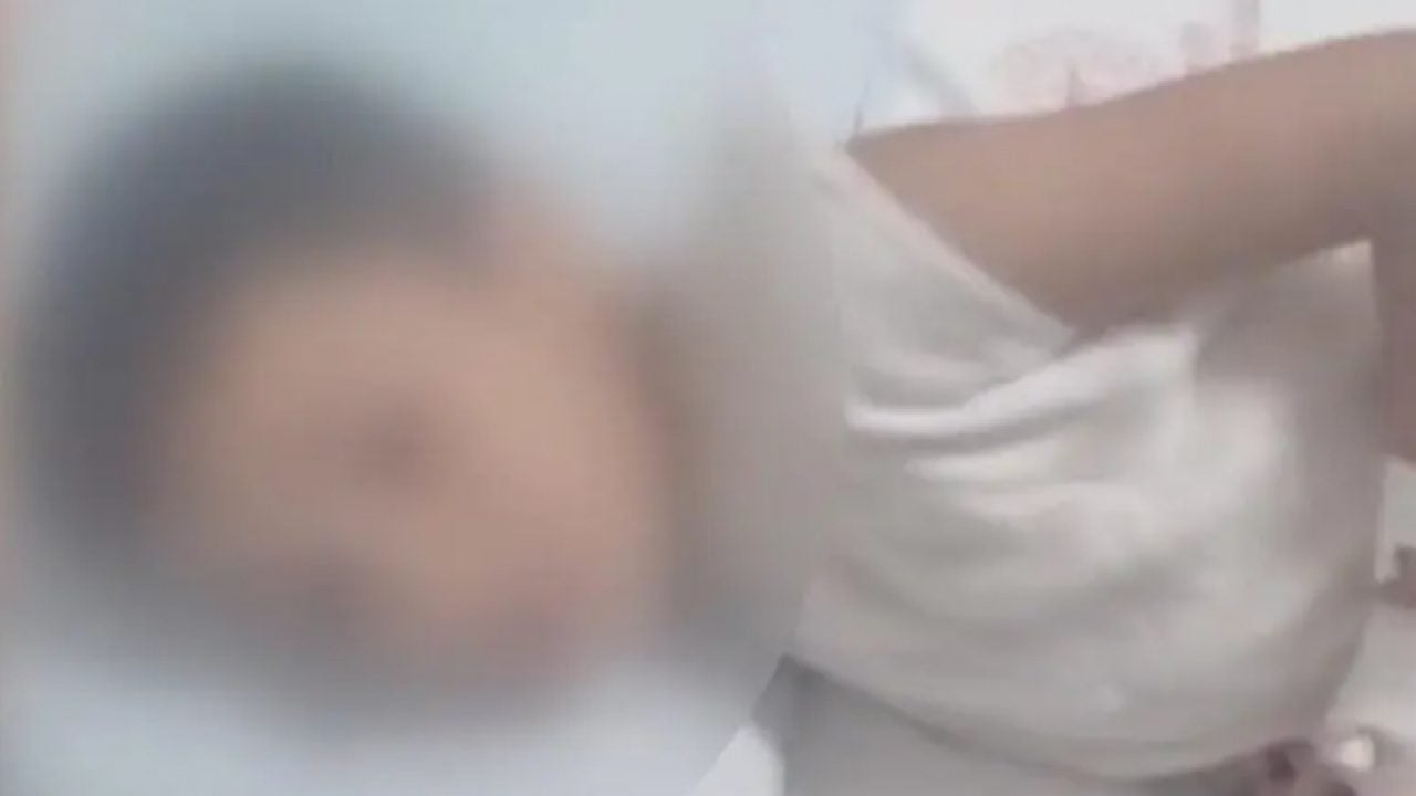 Foto - Arnavutköy'de akran dehşeti: 12 yaşındaki çocuğu yaktılar!