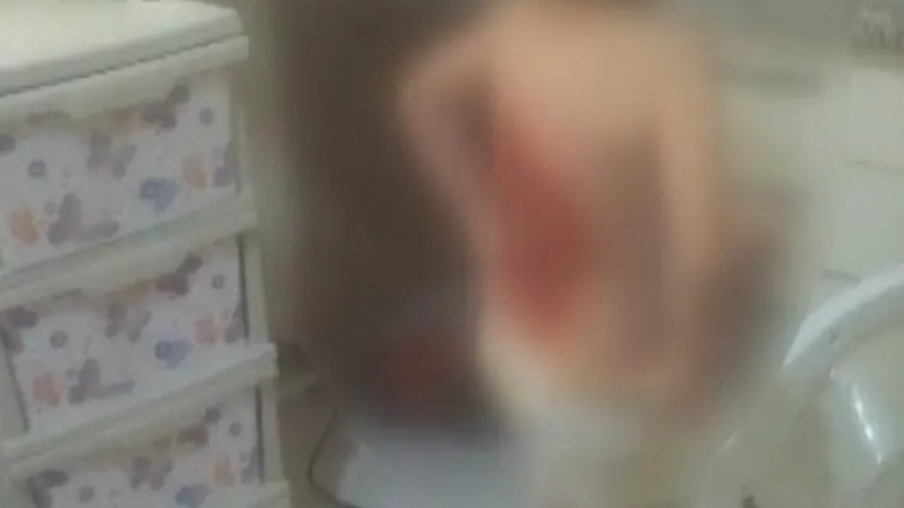 Foto - Arnavutköy'de akran dehşeti: 12 yaşındaki çocuğu yaktılar!