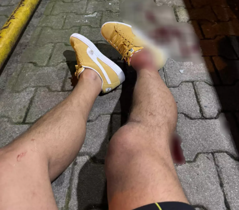 Foto - Ali Koç'u eleştiren Serhat Akın vuruldu! Silahlı saldırıya uğradı