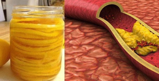 Almanlar bu tarifi yıllardır biliyor! Damarlarda biriken kolesterole yağ çözücü etkisi yaratıyor