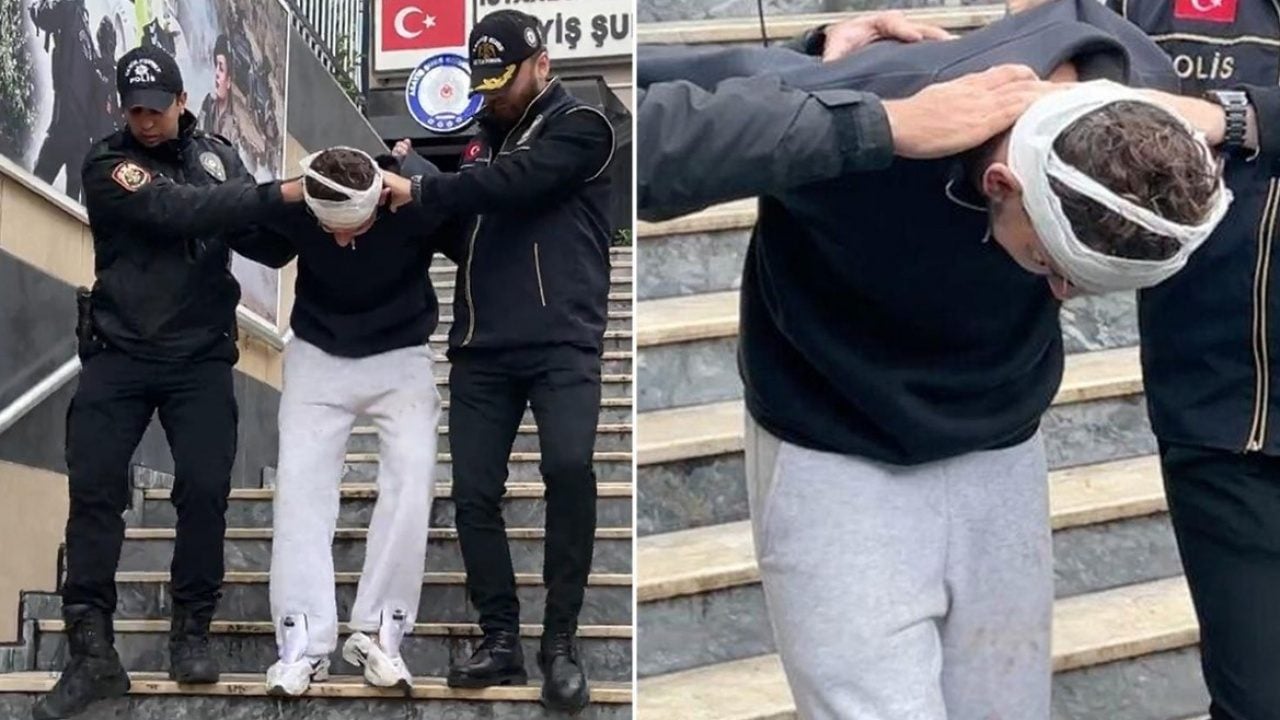 Foto - Almanya’da 4 milyon dolar çarptı! Türkiye’de estetik masasında enselendi