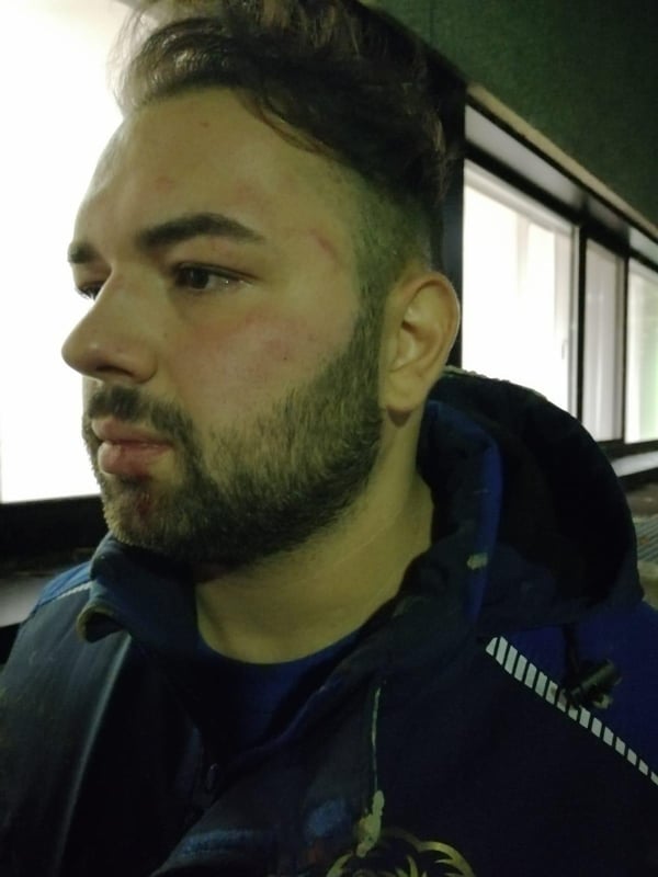 Almanya'da büyük skandal! Polisler Türk iş adamını darp etti