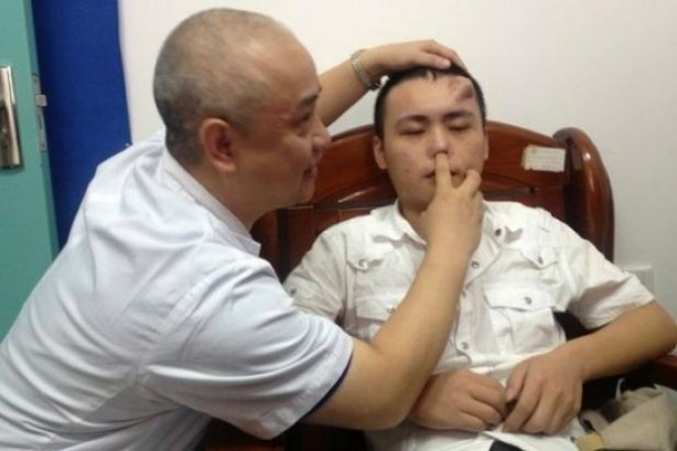 Foto - Alnında burun çıktı