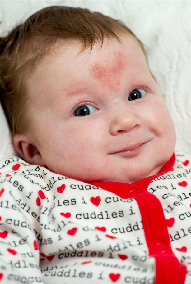 Foto - Alnını gören hayret ediyor!